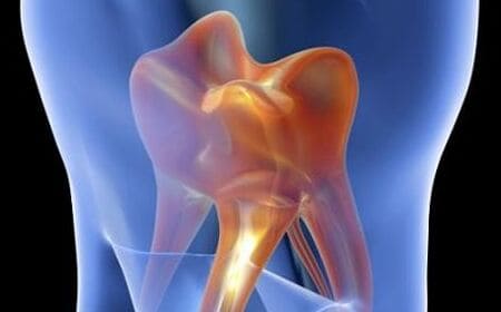 Konzervativna terapija Crnojević Dental Studio